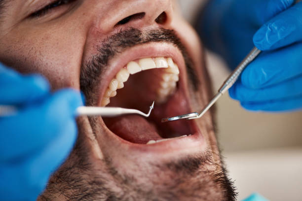 Best Emergency Root Canal Treatment in Tucson Estates, AZ